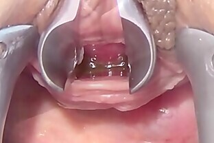 Masturbate Peehole with Toothbrush and Chain into Urethra 2 min